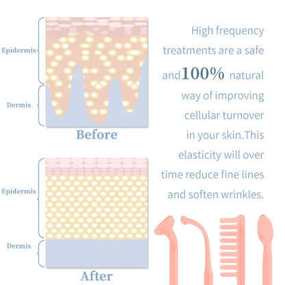 Handheld High Frequency Skin Therapy Wand